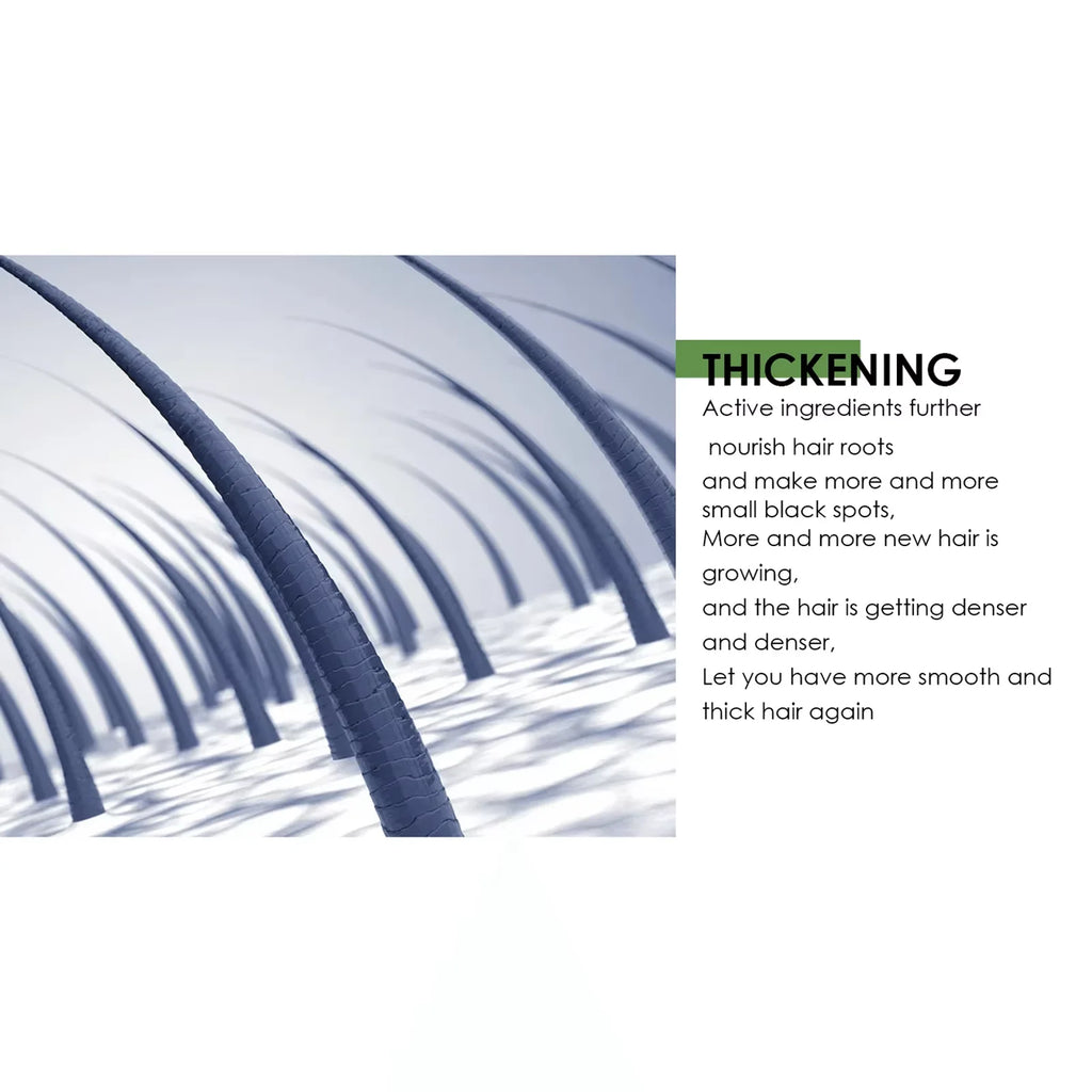 Spray para el crecimiento del cabello, antipérdida de cabello, calvicie, reparación de raíces del cabello, tratamiento del cuero cabelludo dañado, suero líquido espesante, belleza más larga y salud