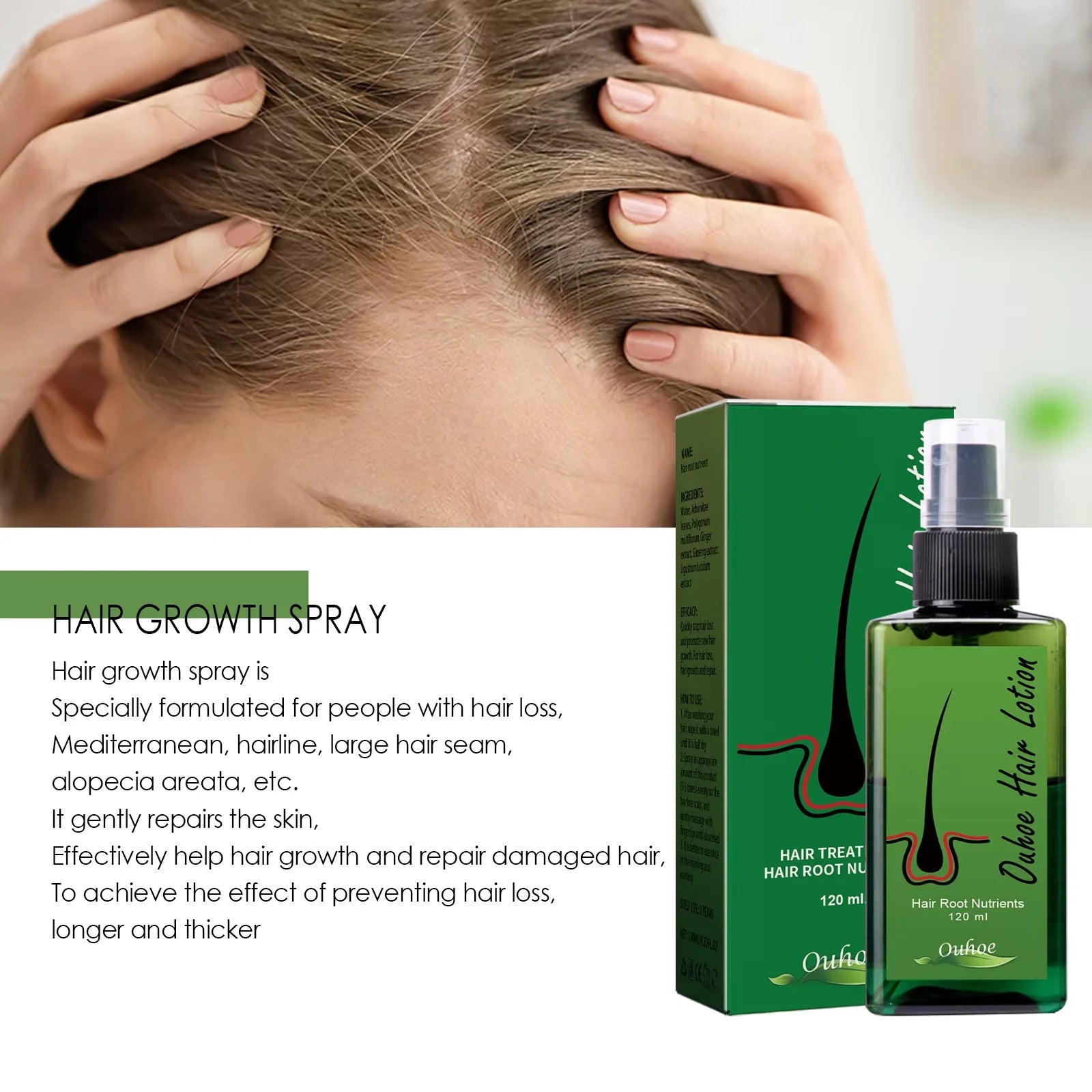 Spray para el crecimiento del cabello, antipérdida de cabello, calvicie, reparación de raíces del cabello, tratamiento del cuero cabelludo dañado, suero líquido espesante, belleza más larga y salud